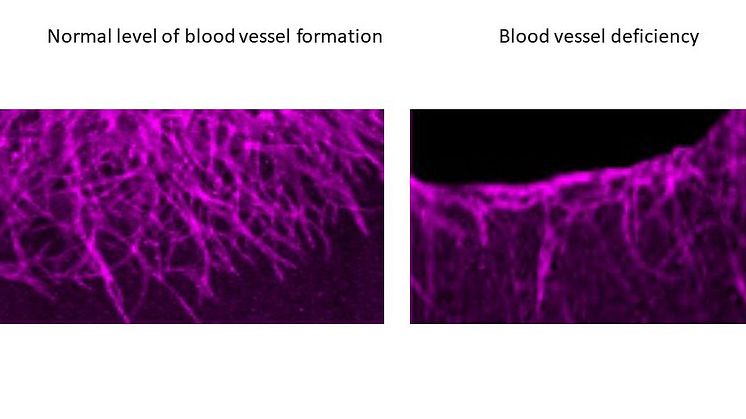 Mekanism för hur nya blodkärl bildas upptäckt