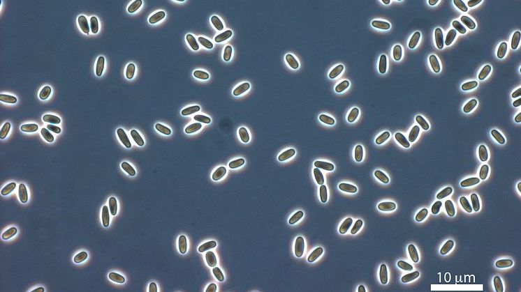 Light mMicroscopy image of microsporidian spores of Vairimorpha necatrix. Picture by Charles Vossbrinck