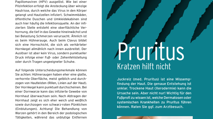 Pruritus - Kratzen hilft nicht