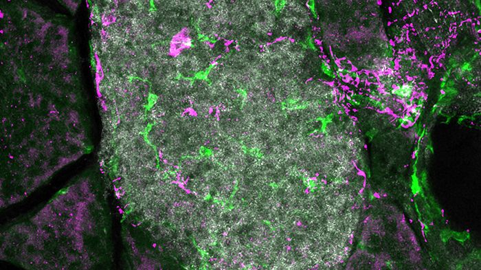 Sympatiska nervfibrer (magenta) kan ses i nära anslutning till makrofager (en typ av immuncell, gröna) i en Langerhansk cellö (grå) i bukspottkörteln från en mus.