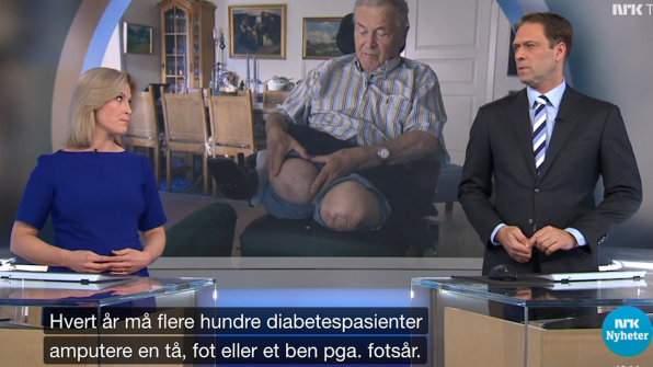 Diabetespatienter amputerar dagligen