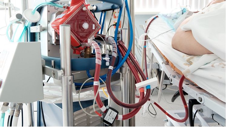 VentriLabs´ innovative gravity pump technology can be used for gentle pumping of blood.