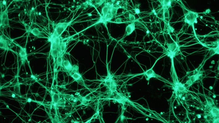 Mikroskopbild på neuroner som härstammar from P19-celler från mus. Nervcellerna är märkta med ett fluorescerande ämne. Bild: Dina Popova.