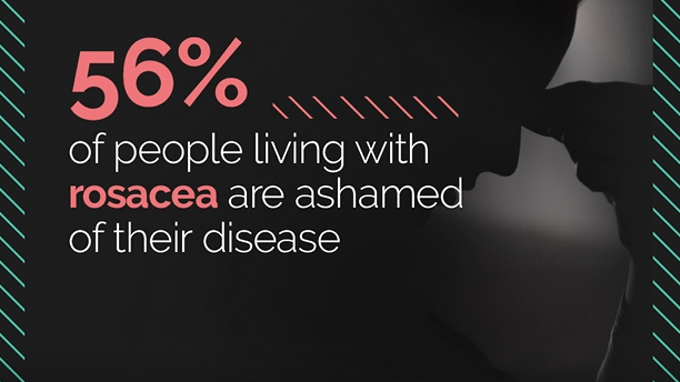 56% av personer som lever med rosacea skäms över sin åkomma.