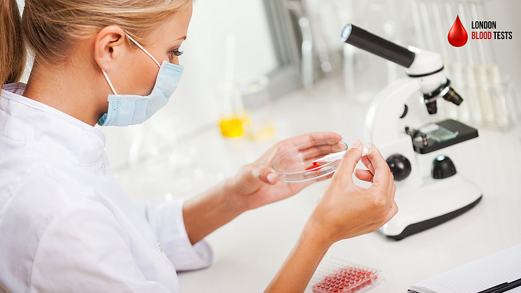 London Blood Tests offers Lipid Profile private blood testing thorough the UK.