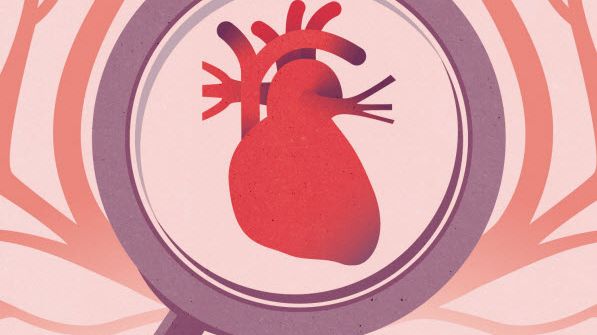 Bristen på hjärtdonatorer är den viktigaste faktorn till att fler patienter inte kan hjärttransplanteras.