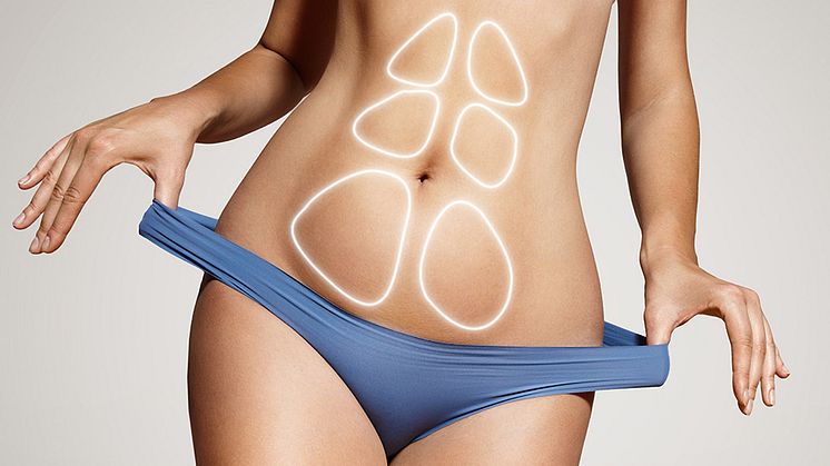 Health Benefits of Liposuction You Probably Didn’t Know About