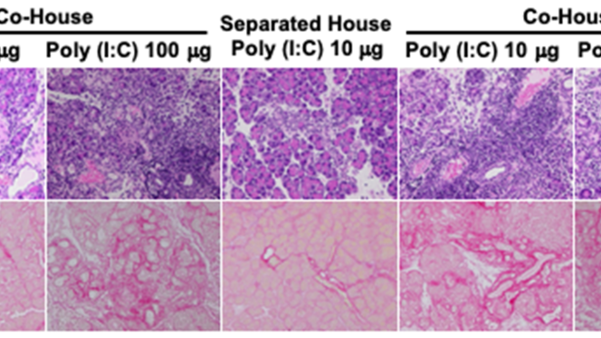 Top row: Pancreatic inflammation observed by hematoxylin & eosin staining    Bottom row: pancreatic fibrosis observed by sirius red staining