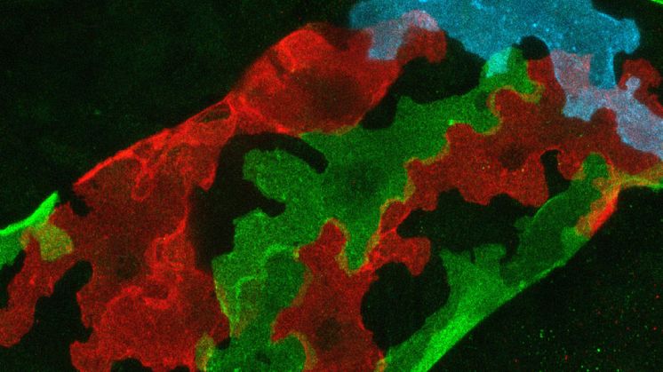 Lobate shape of mammalian lymphatic endothelial cells. Photo: Hans Schoofs