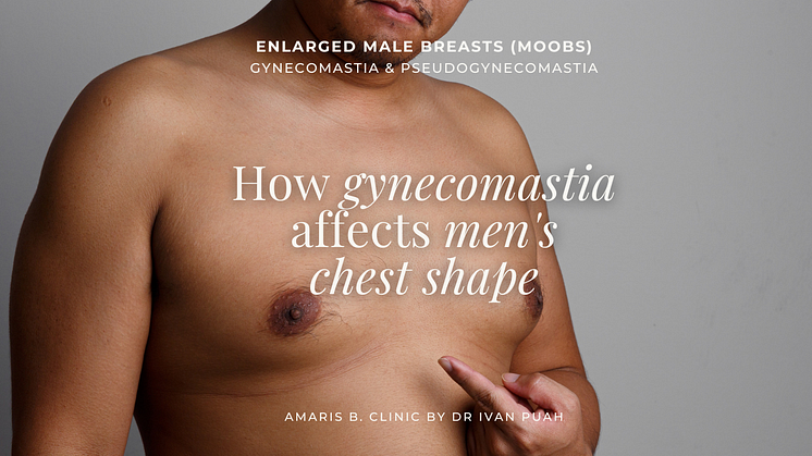 How Gynecomastia Affects Men’s Chest Shape