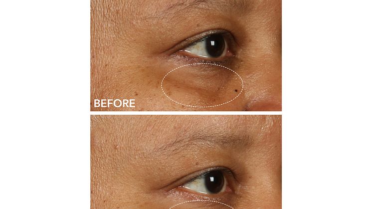 DermInfusions™ Fill + Repair Eye Cream 