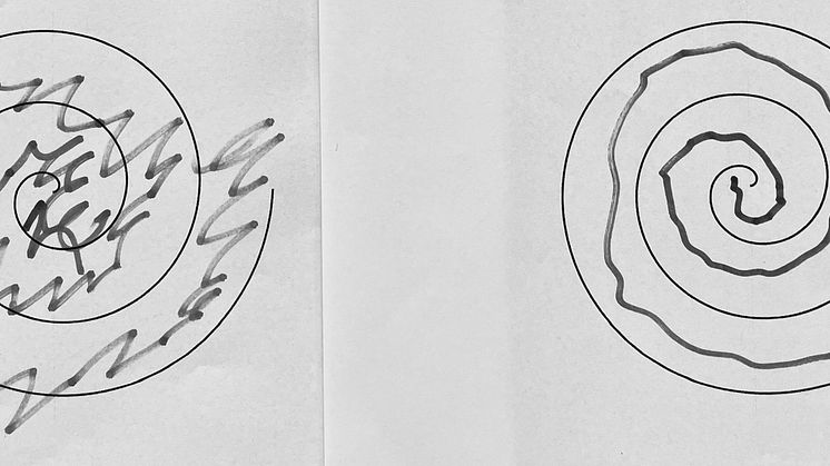 Rita spiral före och efter behandling.jpg