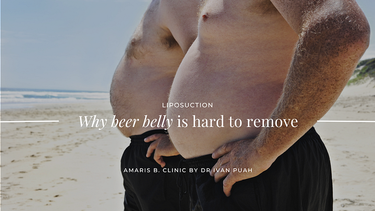 Why beer belly is hard to remove