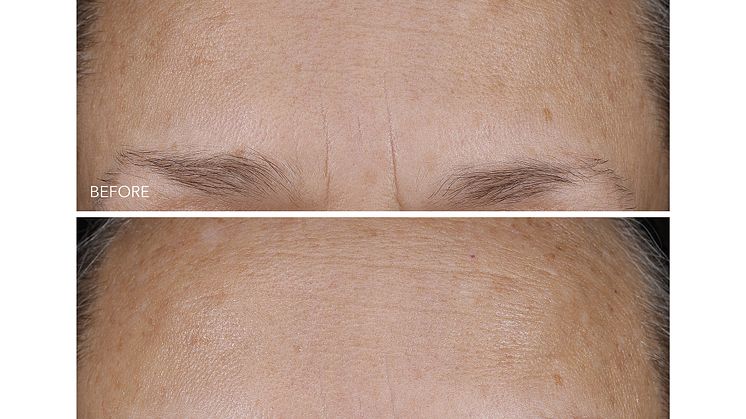 DermInfusions Blur + Repair Cream
