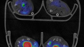 PET CT-bild av möss (transversal vy) med tumörupptag av Fluor-18.png