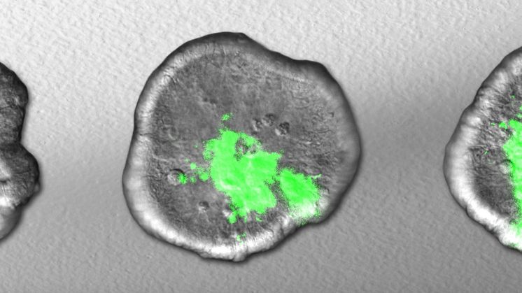 Organoid