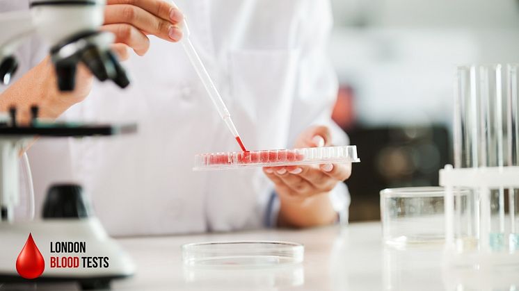london-blood-tests-cystatin-c-blood-test.jpg