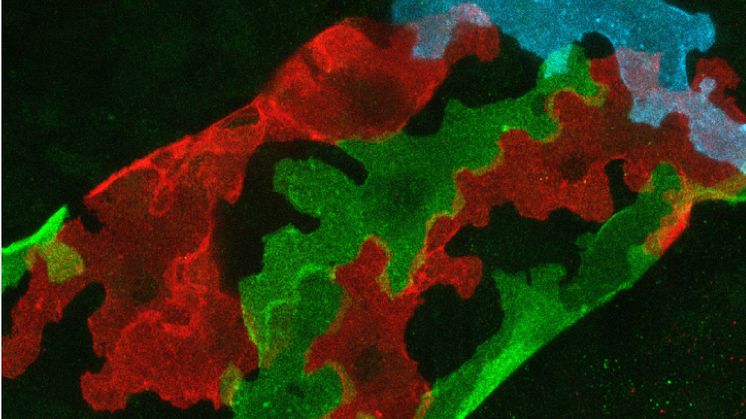 Lymphatic endothelial cells