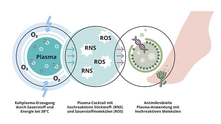 Kaltplasma in der Podologie