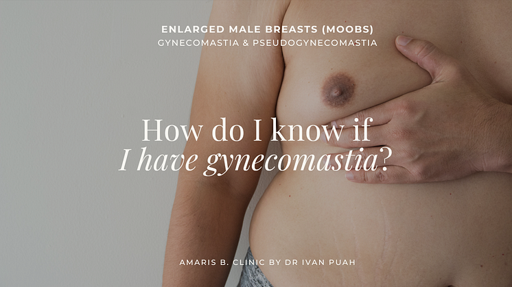 How do I know If I have gynecomastia?