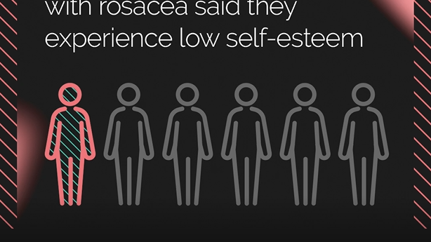 34% av personer som lever med rosacea säger att de har låg självkänsla