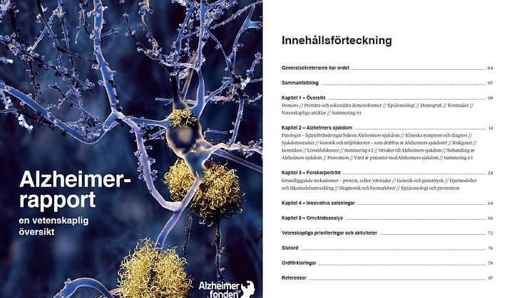 Sveriges första Alzheimerrapport ska öka kunskapen om demenssjukdomar