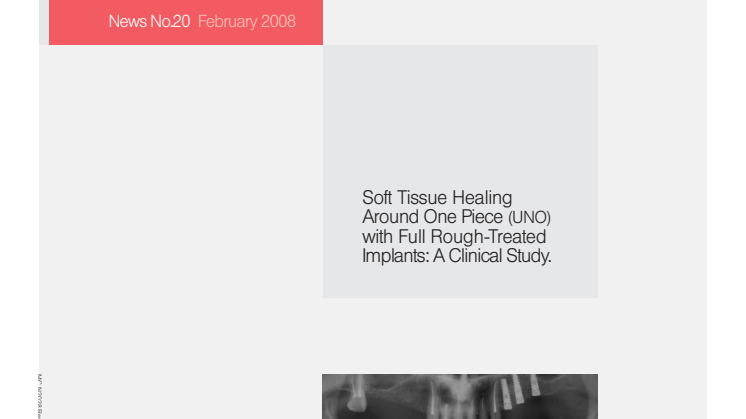 Soft Tissue Healing Around One Piece (UNO) with Full Rough-Treated Implants: A Clinical Study 