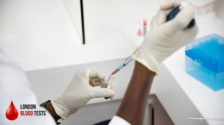 London Blood Tests offers TSH (Thyroid Stimulating Hormone) blood testing for the price of £48.