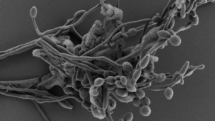 Candida albicans I elektronmikroskop