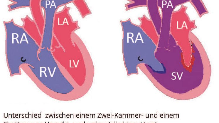 Biventrikuläres-Herz_Univentrikuläres-Herz_Universität-Kansas2023