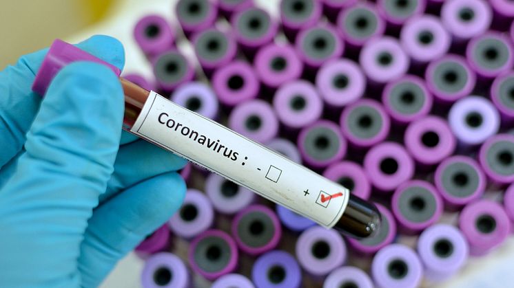 Linköpings universitet har flera forskare som från olika perspektiv kan kommentera coronaviruset SARS-CoV-2 och covid-19