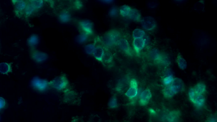 Celluminova och PU sensor aktuella för finansiering värd 7,6 miljoner
