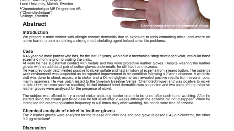 Allergic contact dermatitis from nickel is prevented using a novel barrier cream