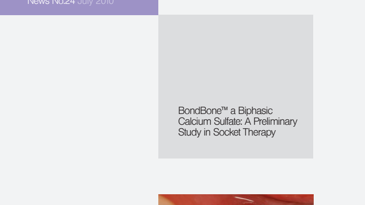 BondBone - Study