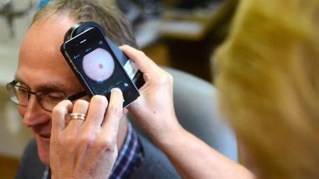 Jämlik vård med teledermatoskopi