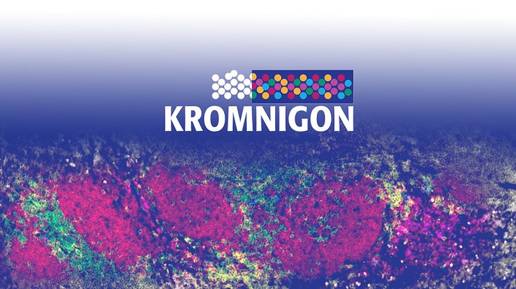Kromnigon genomför emission som tillför bolaget 5 Mkr