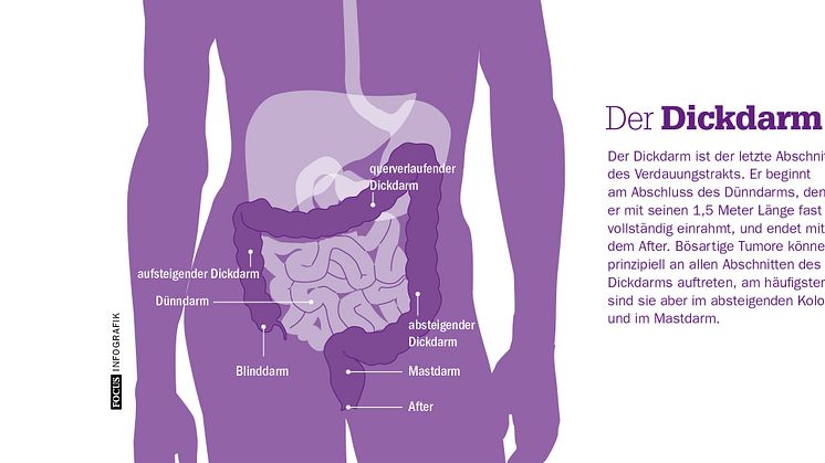 Der Dickdarm. FOCUS Infografik