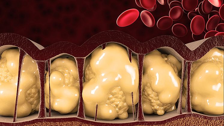 Fat Cells Can Be Retrained!