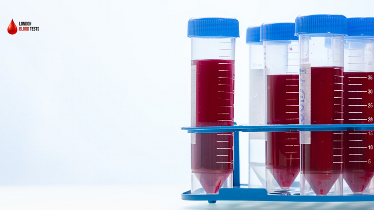 London Blood Tests offers FSH blood tests all around the UK.