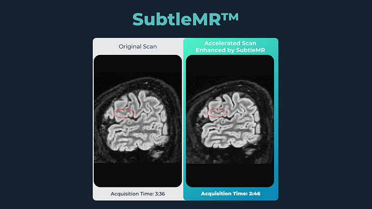 Unilabs Sweden Launches Subtle Medical’s AI-powered Imaging Technology to Further Bolstering Patient Care