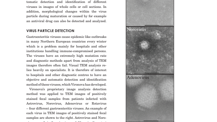 Diagnosing Viral Infections 