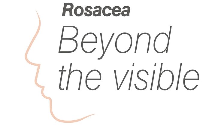 Ny global undersökning visar på stor social påfrestning för patienter med rosacea 