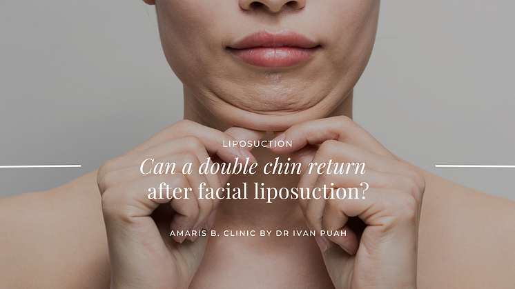 Can A Double Chin Return After Facial Liposuction?