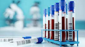 Comment from the Stroke Association: Stroke and a Person’s Blood Type (published in American Academy of Neurology journal.)