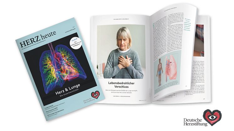 Gefahr durch verstopfte Lungengefäße: In HERZ heute erläutern renommierte Herz-/Lungenspezialisten Ursachen, Symptome und Therapie der Lungenembolie.