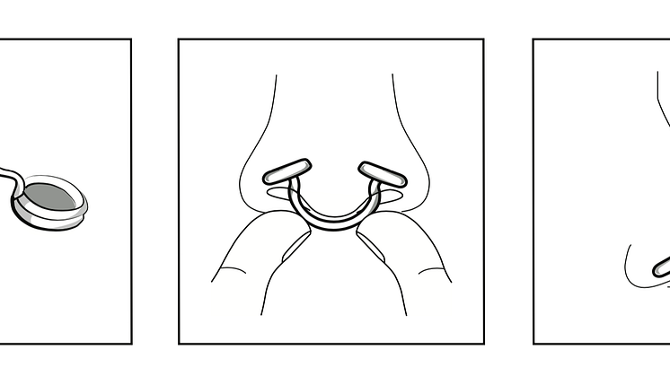 Näsfilter, illustration