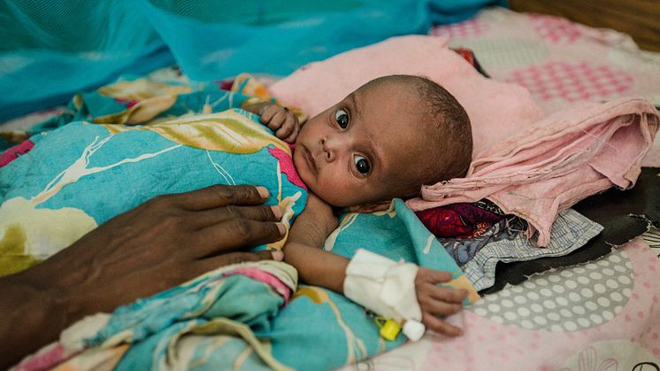 Dahir, sex månader gammal, får behandling på Rädda Barnens mottagning för akut undernärda i Borama, Somaliland. Foto: Colin Crowley/Rädda Barnen 