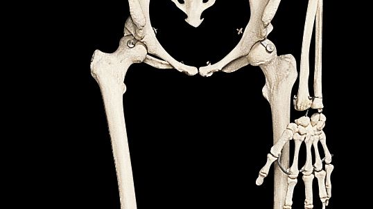 Skelettet