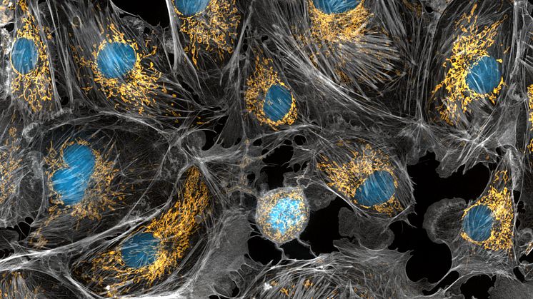 Mitochondria in cells are one example of an endosymbiotic relationship. In this photograph taken with a microscope, the mitochondria were stained in bright yellow. Photo: Torsten Wittmann, University of California, San Francisco