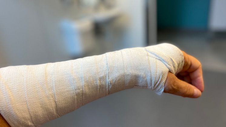 Brukket arm